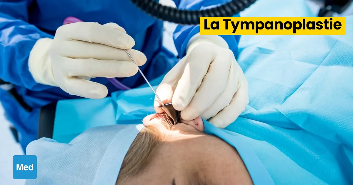 La Tympanoplastie : Restaurer l'Audition, Retrouver la Qualité de Vie